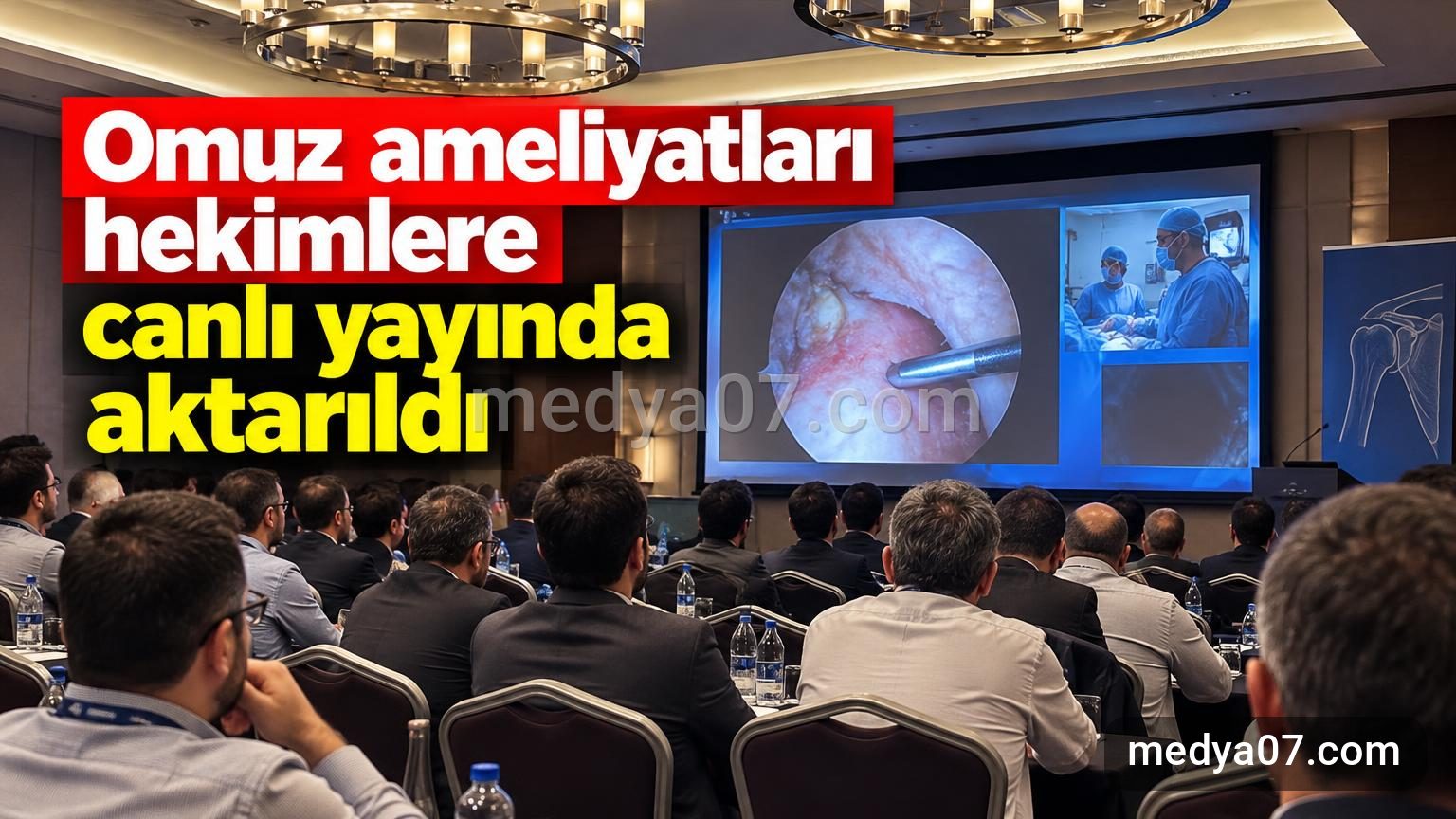 Omuz ameliyatları hekimlere canlı yayında aktarıldı